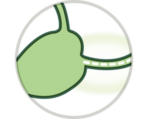 Simbol de micșorare a stomacului