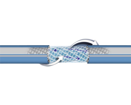 Repararea furtunului cu stent pentru restabilirea fluxului